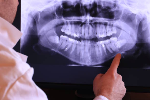Best Emergency Denture Repair in Beverly Hills, MI