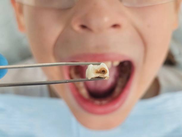 Best Cosmetic Emergency Dentistry in Beverly Hills, MI